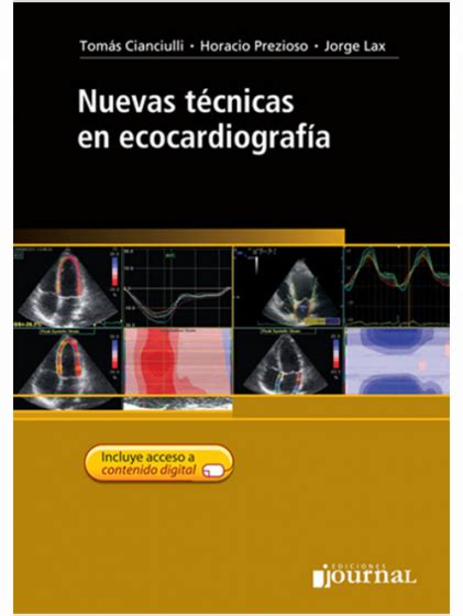 Nuevas Técnicas En Ecocardiografía Editorial Occidente