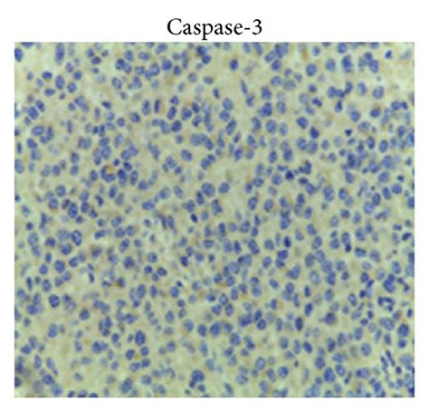 Bcl Bax And Caspase Protein Expressions In Nude Mouse Xenografts My