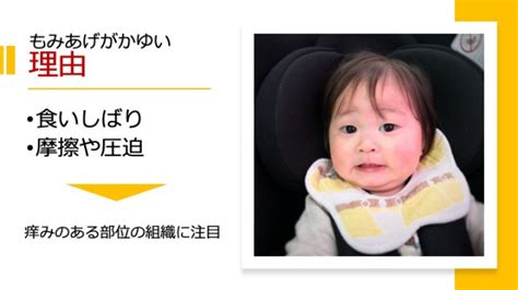 もみあげがかゆい原因と対処 | 川崎市多摩区のアトピー専門 ...