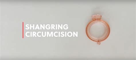Circumcision Shangring Device Vcc