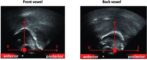 Ultrasound Midsagittal Tongue Contours At The Midpoint Of The Vowel I