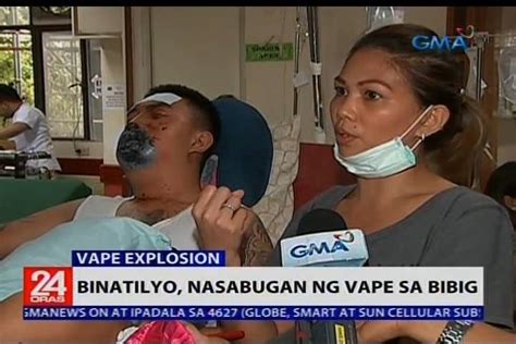 Gma News Binatilyo Nasabugan Ng Vape Sa Bibig Facebook