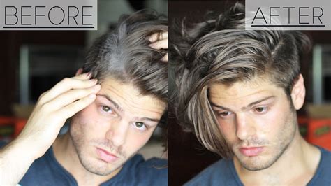 This pack is one of the most effective home remedies to get rid of dandruff. Dandruff Treatments And prevention In Depth Guide 2017