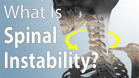 Spinal Instability Shimspine