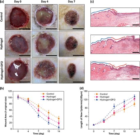 Wound Healing Studies Of Sd Rats Injected With Dfo Hydrogels In Vivo A