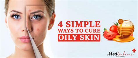 4 Simple Ways To Cure Oily Skin Medonlinepk