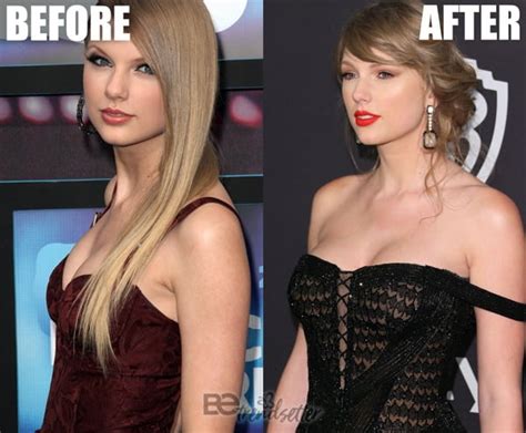Taylor Swift Plastic Surgery Mystery SOLVED!