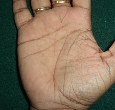 Reading A Palm Lifeline