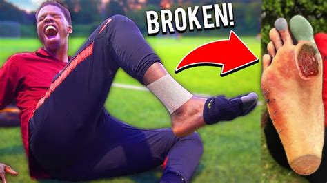 This Football Team Broke My Foot In This Soccer Match Injury Youtube