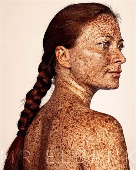 Freckles Portrait Photography Brock Elbank 145700 — How To Be A Redhead