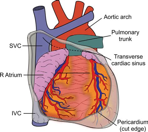 Relationship Of The Svc To The Pericardium Schematic Diagram By