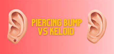 Piercing Bump Vs Keloid How To Tell The Difference 2024 Update Drug Genius
