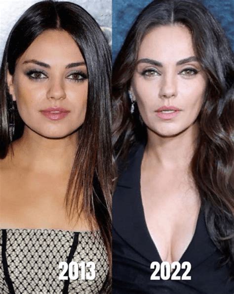 Mila Kunis Plastic Surgery Then And Now