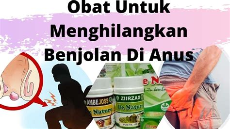 Obat Untuk Menghilangkan Benjolan Di Anus Youtube