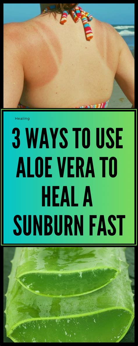 3 Ways To Use Aloe Vera To Heal A Sunburn Fast Heal Sunburn Sunburn