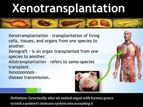 Xenotransplantation Ppt