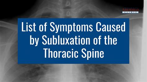 List Of Symptoms Caused By Subluxation Of The Thoracic Spine Youtube