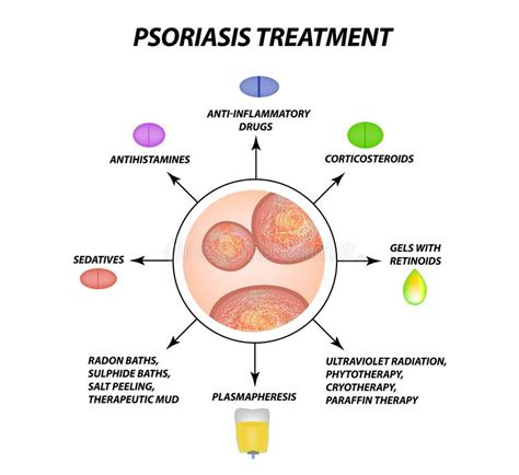 Psoriasis Treatment Eczema Dermatitis Skin Disease Psoriasis