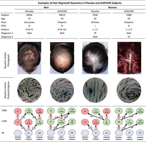 Frontiers Sex Differences In Clinical Trials Of Alrv5xr Treatment Of Androgenetic Alopecia And