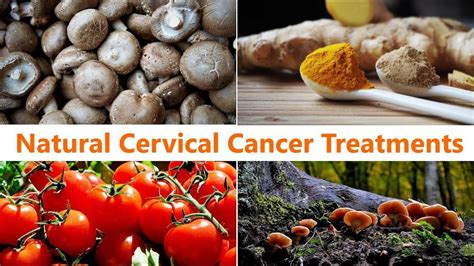 8 Best Natural Cervical Cancer Treatments Youtube