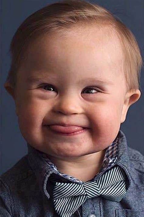 Boy With Down Syndrome Turned Down At Casting Call Baby Kind Little