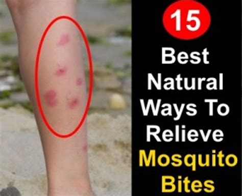 Bed Bug Bites Or Ringworm Whadoq