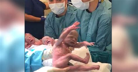 Video Of Triplets Arriving Via C Section Inspiring Moment Shared By Mom