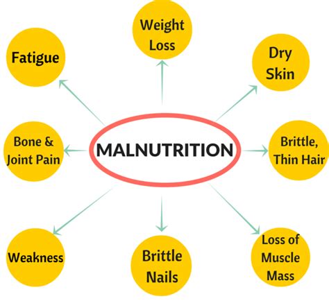 Malnutrition Forms Causes Signs And Symptoms Treatment And Prevention