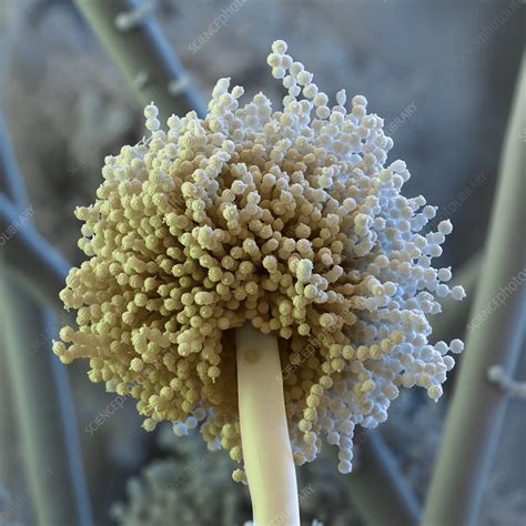 Aspergillosis (aspergillus infection) is an infection caused by a white fungus. Aspergillus fungus, SEM - Stock Image - B250/1892 ...