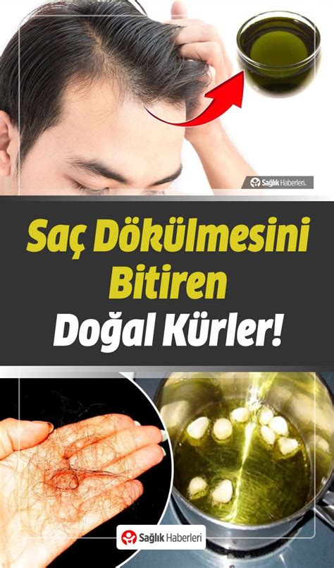 Saç Dökülmesi Sebepleri Nelerdir? Nasıl Önlenir? Ne İyi Gelir? - Sağlık