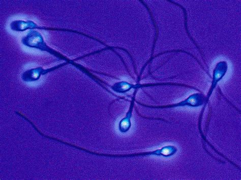 A New Experimental Approach To Male Birth Control Immobilizes Sperm