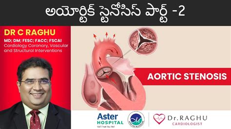 How To Diagnose Aortic Stenosis Treatments Of Aortic Stenosis Dr