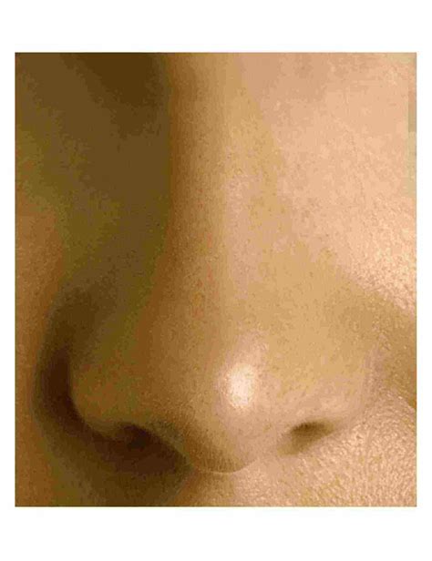 Nose Jobs Make You Look Younger
