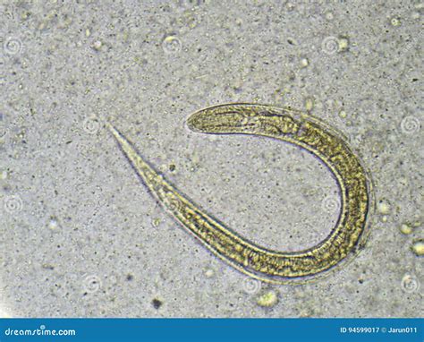 Strongyloides Stercoralis Or Threadworm In Human Stool Stock Photo