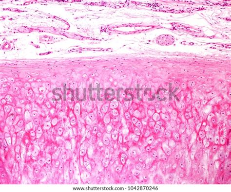 Elastic Cartilage Human Epiglottis Showing Isolated Stock Photo