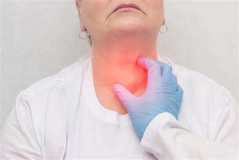 Symptoms Of Hashimotos Thyroiditis Signs And Symptoms Of Goiter And