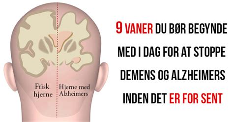 Pflegehilfe.org has been visited by 10k+ users in the past month Alzeimer Og Demens Hvor Arveligt Er Det / Kan ha funnet ny ...