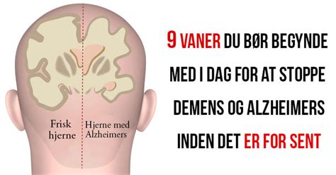 Noen andre typer demens inkluderer parkinsons sykdom og huntingtons sykdom. 9 vaner du skal begynde med i dag hvis du vil stoppe demens og alzheimers inden det er for sent