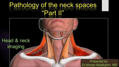 9 Pathology Of The Neck Spaces Part Ii Youtube
