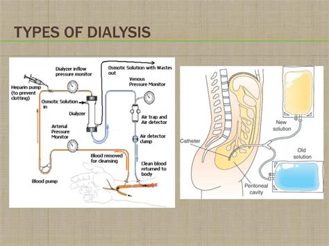 Ppt Chapter 26 Acute Renal Failure And Chronic Kidney Disease