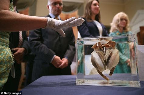 Worlds 1st Artificial Heart At The Smithsonian Museum 40 Years After