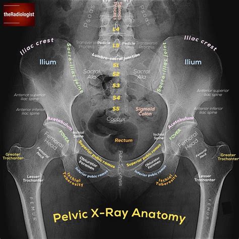 Pelvic Bone Anatomy Xray Mamie Stewart