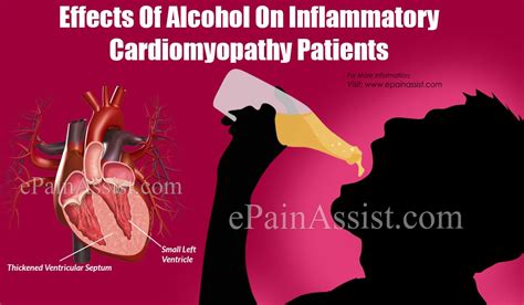 Effects Of Alcohol On Inflammatory Cardiomyopathy Patients