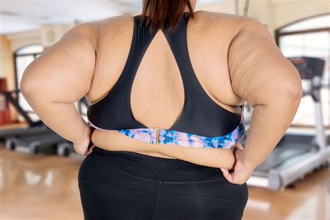 Will All Morbidly Obese People Eventually Get GERD? » Scary Symptoms