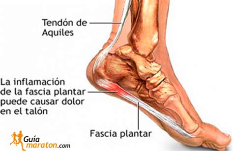 1 ¿por qué duelen los pies al pisar? La Fascitis Plantar, el dolor de la planta del pie al ...