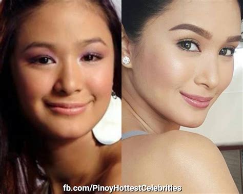 Before And After Photos Of Filipino Celebrities