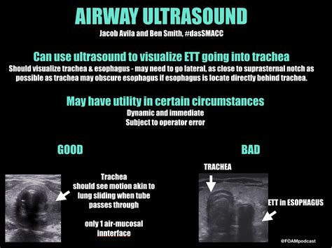 Dassmacc Airway Ultrasound Critical Care And Dunning Kruger Foamcast