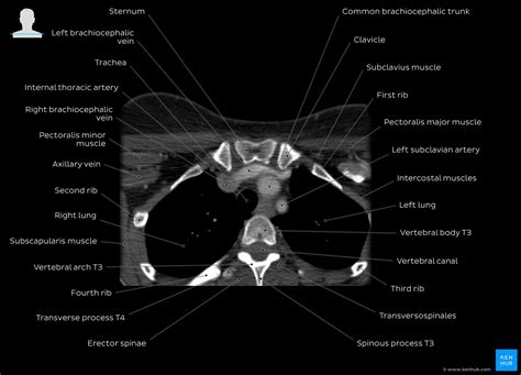 Radiological Anatomy X Ray Ct Mri Kenhub