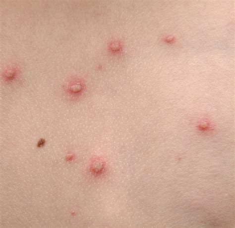 Select The Statement That Best Describes Skin Disorders