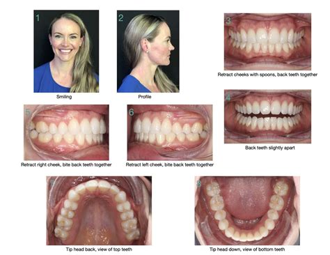 Virtual Consultation Baird Orthodontics Pleasanton Ca